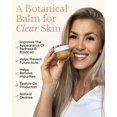 thumbnail image 2 of Bálsamo FRØYA Organics Control de Imperfecciones y Alivio del Enrojecimiento 30 mL, 2 of 9