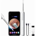 thumbnail image 1 of Ear Otoscope, Endoscope Ear Cleaning Kit, HD Camera Ear Cleaning with 6 LED Lights, 3.6mm Wireless WiFi，For Smart Phone, 1 of 5