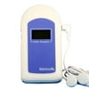 Authentic Baby Sound B Fetal Doppler with Built-In Probe and LCD