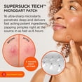 thumbnail image 2 of Parches para espinillas ZitSticka Killa Mini, 24 unidades, para rostro, 2 of 8