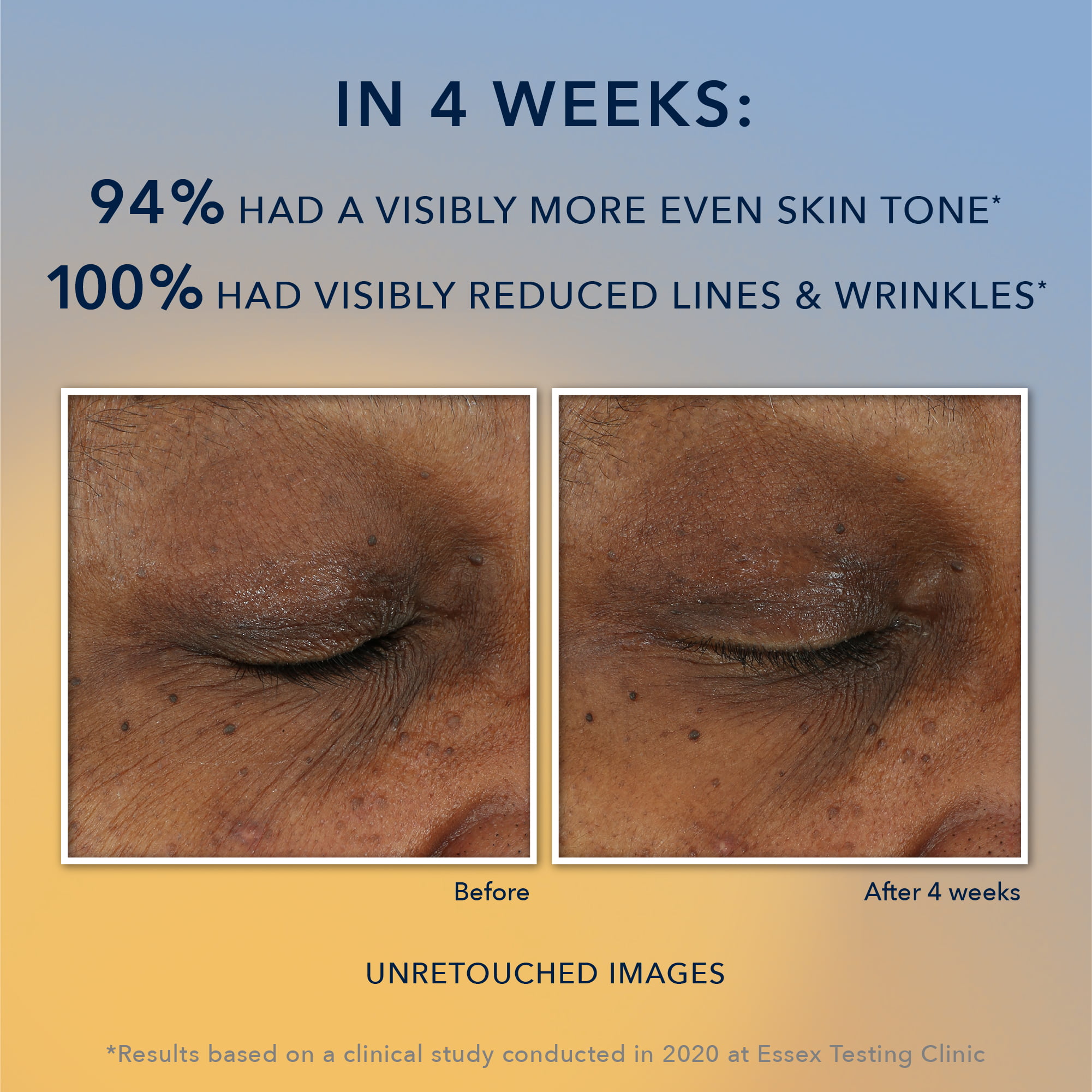 RoC Multi Correxion Brightening Anti-Aging Serum with Vitamin C, for Dark Spots & Uneven Tone, All Skin Types 1oz - image 3 of 13