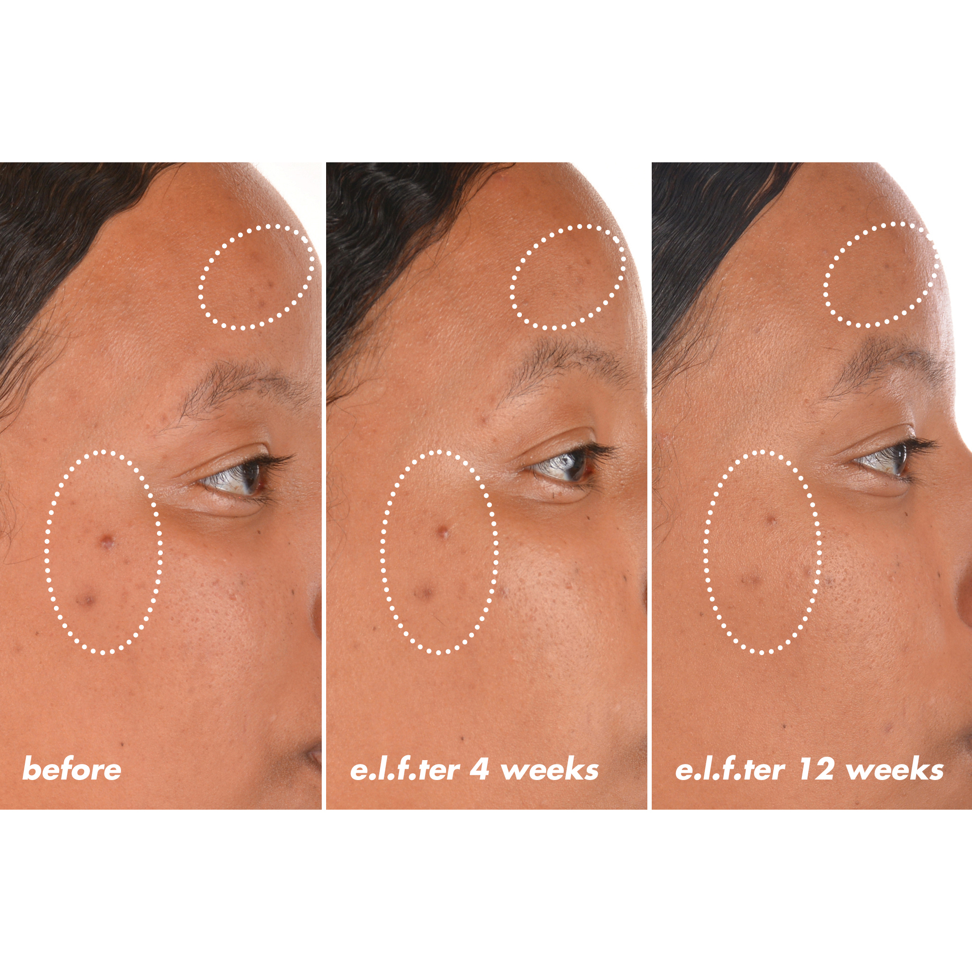 e.l.f. SKIN Bright Icon Vitamin C + E + Ferulic Serum photo 3