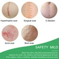 thumbnail image 2 of Aliver 4 Reusable Scar Silicone Scar Sheet, Silicone Tape for Scar Tape, 2 of 7