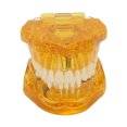 thumbnail image 2 of Modelo De Dientes Dentales, Modelo Patológico Dental Estructura Clara Modelo De Exhibición De Dientes Educativos Amarillo Transparente, 2 of 5