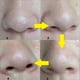 thumbnail image 4 of Mascarilla para eliminar puntos negros de la nariz Tira de poros de contracción profunda (Butterfly Black) Tmvgtek Cuidado Belleza, 4 of 6
