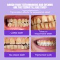 thumbnail image 2 of Pasta blanqueadora dental 3D, blanqueadora, amarillenta y decolorante 2 cajas, 2 of 5