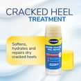 thumbnail image 4 of Dr. Scholl's Cracked Heel Repair Balm (2.5oz) 25% Urea. Heals and Moisturizes feet, 4 of 20
