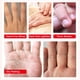 thumbnail image 3 of Máscara de mano, paquete de 5 máscaras de mano, guantes hidratantes, máscara de tratamiento de manos, guantes hidratantes para manos secas, piel áspera hidratante para mujeres o hombres (máscara de mano de lavanda) Ormromra WMXL-54, 3 of 7