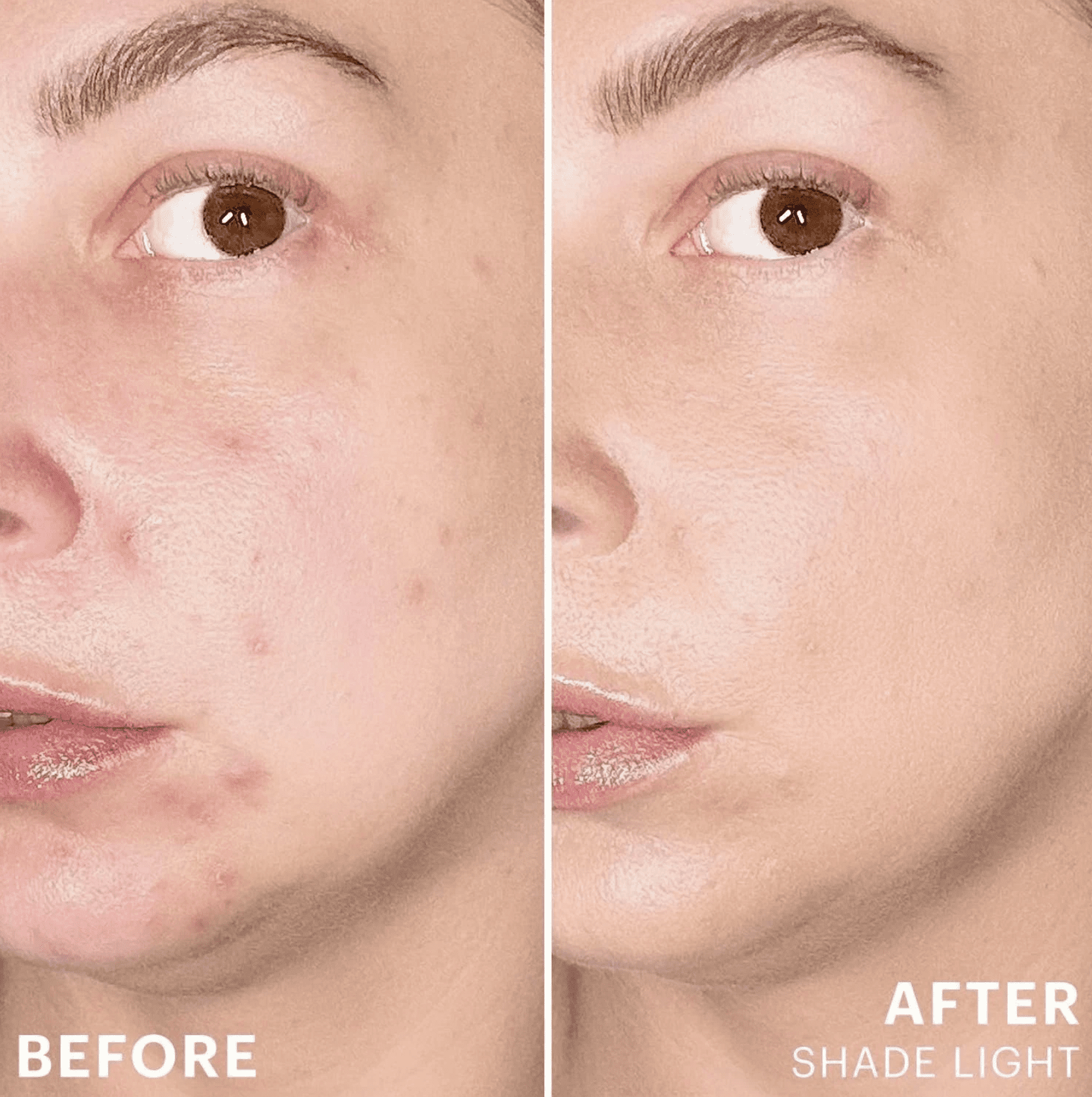 Glo Skin Beauty Spot Treat Concealer, Formulated with Salicylic Acid, Light