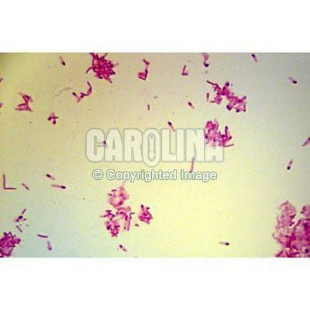 Clostridium Spores  W.M. Microscope Slide price history on PriceWatchPro