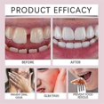 thumbnail image 5 of Super Grip Thermoplastic Denture Adhesive Cream Comfort Secure Hold Denture-Adhesive Cream for False Teeth, 5 of 5