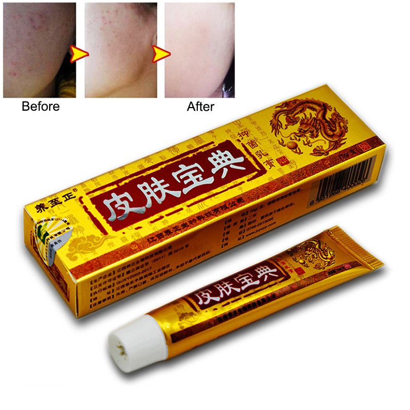 Natural Chinese Medicine Herbal Anti Bacteria Cream Psoriasis Eczema
