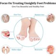 thumbnail image 4 of Separadores de dedos de gel, correctores de juanetes de silicona para dedos curvados y doblados, enderezadores de dedos para mujeres y hombres, herramienta para el cuidado de los pies, 4 of 6
