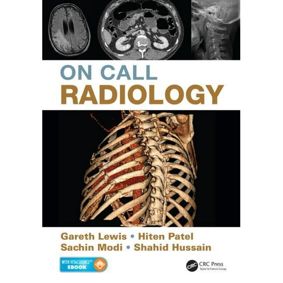 On Call Radiology (Paperback)