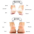 thumbnail image 4 of 2 Pairs Vented Moisturizing Socks Lotion Gel for Dry Cracked Heels, Spa Gel Socks Humectant Moisturizer Heel Balm Foot Treatment Care Heel Softener Compression, 4 of 8