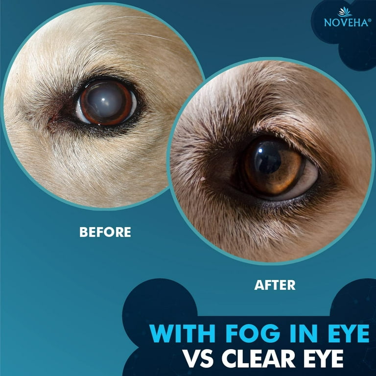 Reverse Cataracts and Improve Eye Health