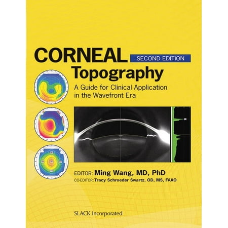 UPC: 9781556429705 | Corneal Topography : A Guide for Clinical Application in Wavefront Era (Edition 2) (Hardcover)