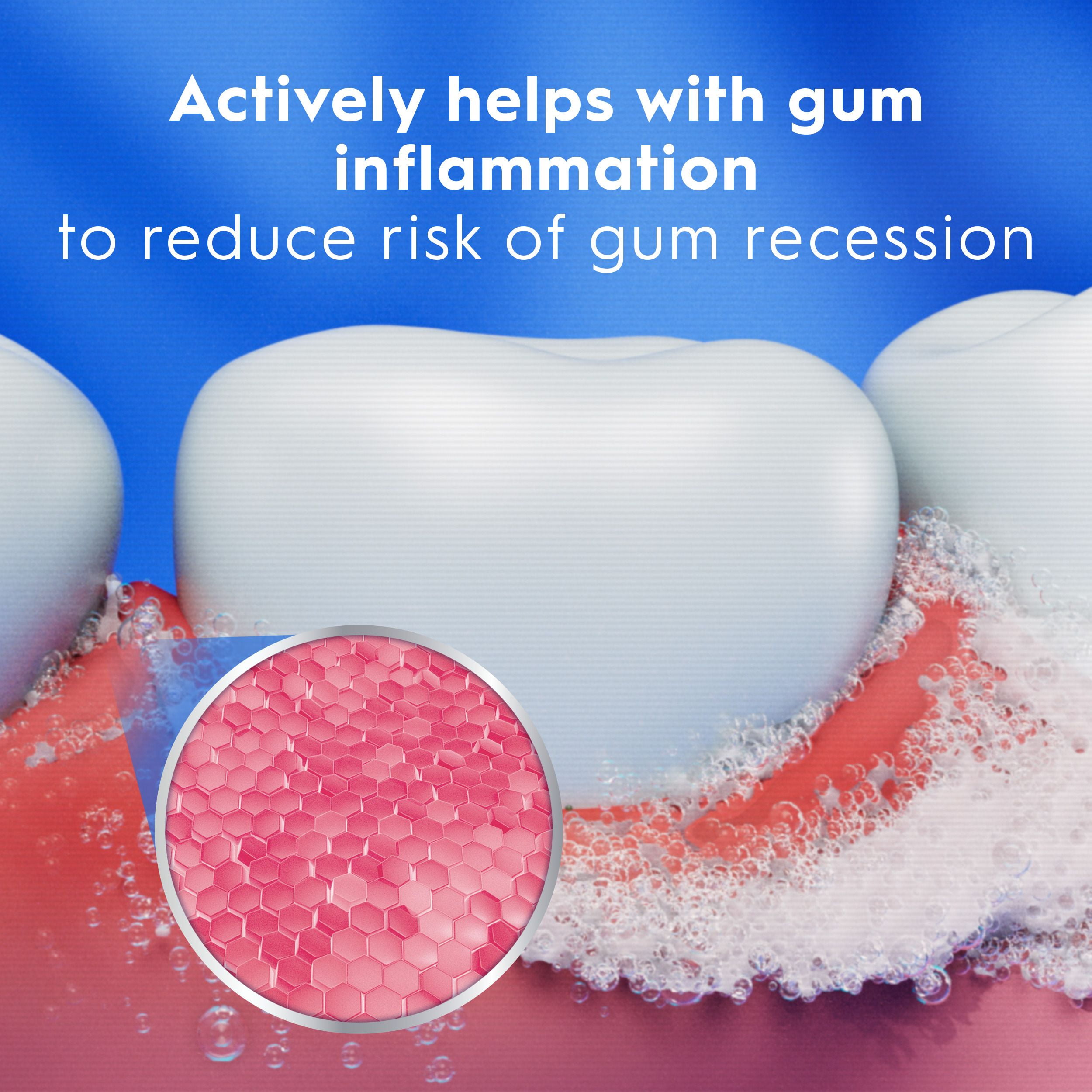 Crest Pro-Health Gum Rescue Toothpaste- Anticavity, Antibacterial Flouride Toothpaste, Clinically Proven Healthier Gums.