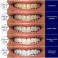thumbnail image 4 of Teeth Whitening Strips, Whitening Strips For Teeth Sensitive, Enamel Safe White Strips Teeth Whiteners Kits Fast Remove Tough Stains, 4 of 5