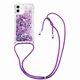 thumbnail image 1 of Funda FOXDOCK para iPhone 12 con Cuerda Ajustable, Brillo Líquido, Protección Antigolpes y Lente – Ideal para Regalo, 1 of 6