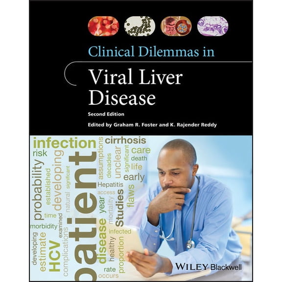 Clinical Dilemmas (UK) Clinical Dilemmas in Viral Liver Disease, (Paperback)