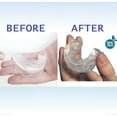 thumbnail image 6 of Sleep Aid Mouth Guard, 6 of 8