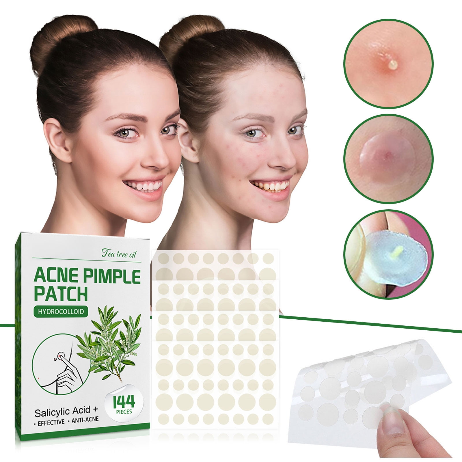 Alvantor Invisible Tea Tree Oil Hydrocolloid Pimple Patches for Face, 144pcs - Waterproof & Breathable