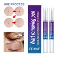 thumbnail image 1 of 2 uds removedor de verrugas pluma para etiquetas de piel papilomas eliminación de lunares herramientas de punto indoloras Sywqhk Cuidado Belleza, 1 of 7