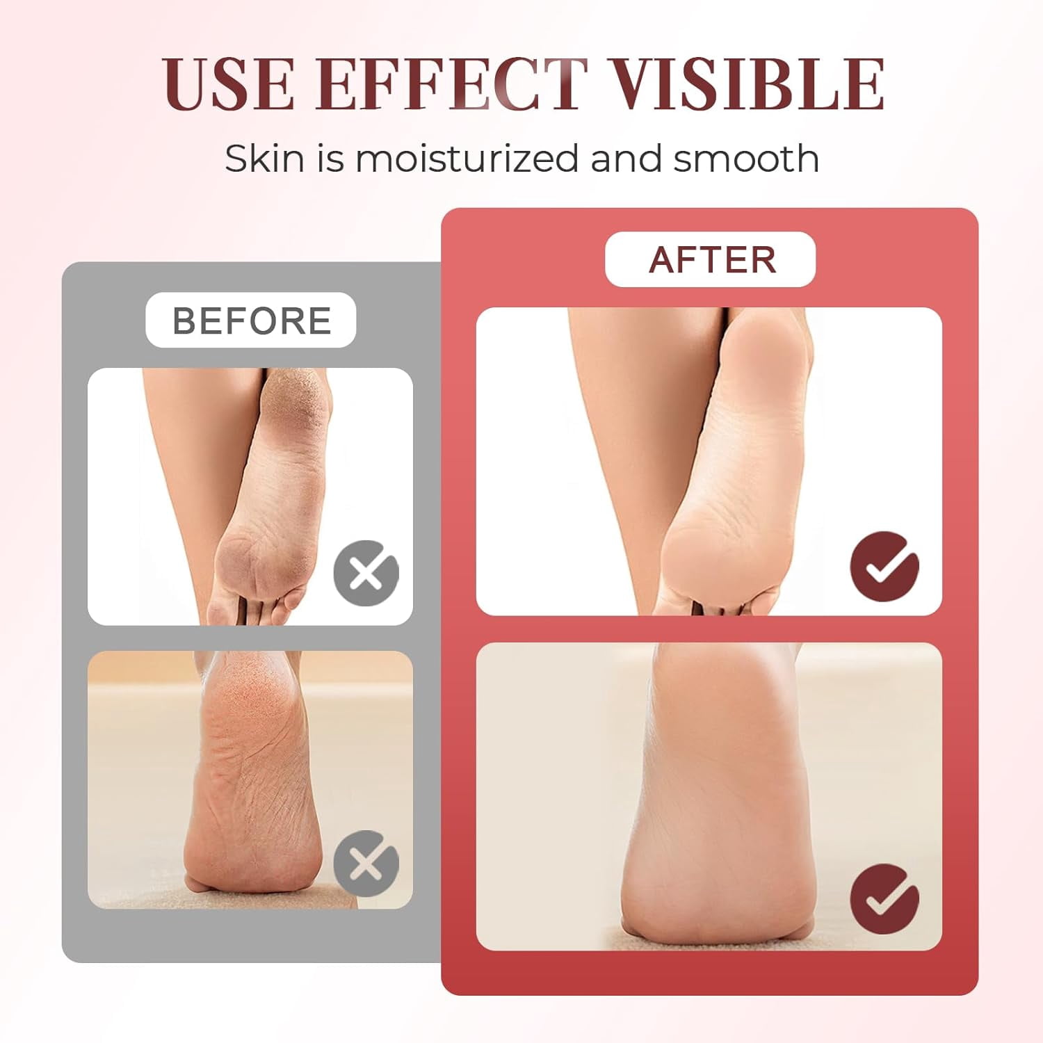 Electric Foot Callus Remover, Upgrade 2 in 1 Electric Foot File with Grinder Heads, Adjustable Foot Sander Pedicure Tools for Feet Dead Skin with Display and Base (Black)