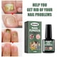thumbnail image 1 of Solución para el cuidado de las uñas de los pies, tratamiento para uñas dañadas, renueva las uñas de los pies dañadas y descoloridas (15 ml), 1 of 3