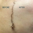 thumbnail image 4 of Kit Dermaplane Ouiloe con aceite y maquinilla de afeitar para mujeres de piel seca, 4 of 5