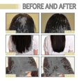 thumbnail image 3 of jaysuing Rosemary dense hair essential oil solid hair dense hair anti-drop improve frizzy hair repair dry hair, 3 of 5