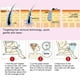 thumbnail image 5 of Hair Removal Cream, Hair Remover Paste, Refreshing Natural Improve Roughness For Nourish Moisturize Your Skin Improve Dryness, 5 of 8