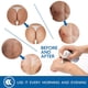 thumbnail image 5 of Tratamiento de limpieza del acné en los glúteos, tratamiento del acné en los glúteos, limpieza del acné, espinillas, granos, protuberancias de afeitar para las nalgas y el área de los muslos, 5 of 7