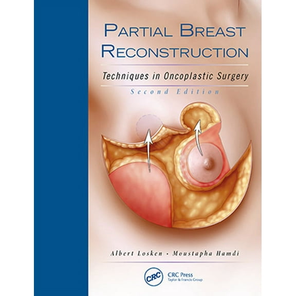 Partial Breast Reconstruction: Techniques in Oncoplastic Surgery (Hardcover)