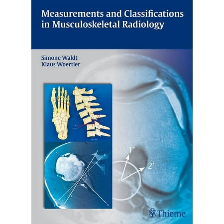 UPC: 9783131692719 | Measurements and Classifications in Musculoskeletal Radiology (Hardcover)