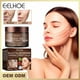 thumbnail image 1 of Crema de eliminación de ácido azelaico 20%, Gel facial para eliminar manchas de acné, Control de aceite, antiacné, encoge los poros, tratamiento para el acné, cicatriz de la piel, 15g"15g" Fivean LED, 1 of 2