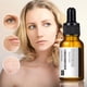 thumbnail image 3 of Suero antienvejecimiento sin arrugas Aceite de esencia para el rostro para la piel antiarrugas 10 ml, 3 of 5