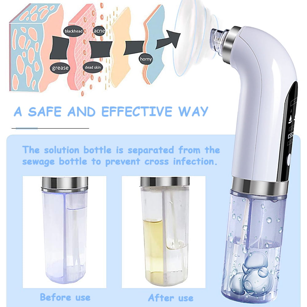 LNKOO Blackhead Remover Pore Vacuum Cleaner - Upgraded Blackhead Vacuum Rechargeable Face Vacuum Comedone Extractor Tool for Blackhead Whitehead Acne Removal, 3 Adjustable Suction Power and 6 Probes