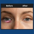 thumbnail image 4 of Eyelid Foaming Cleanser NOVEHA XStye Fast Stye Eye Relief, 4 of 7