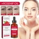 thumbnail image 5 of Aceite facial de rosa mosqueta, aceite esencial de rosa mosqueta, 30 ml., 5 of 9