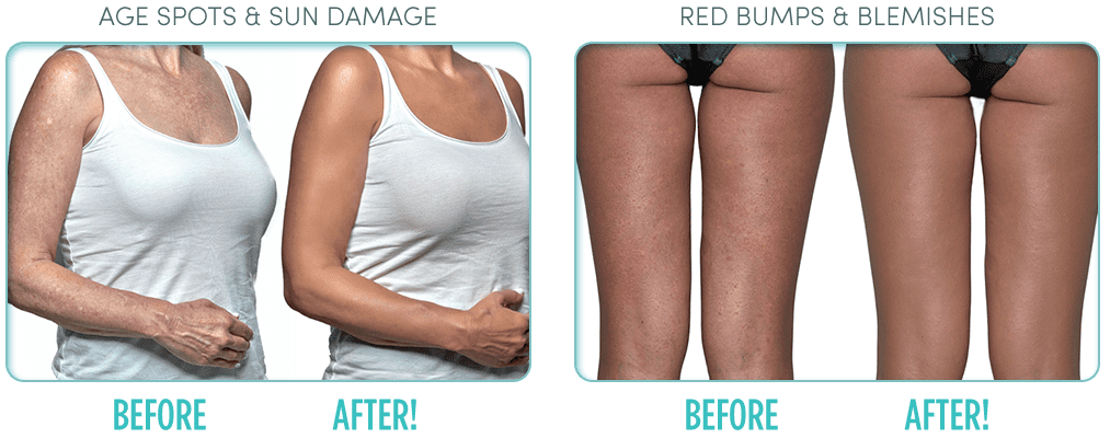 ideal conceal walmart