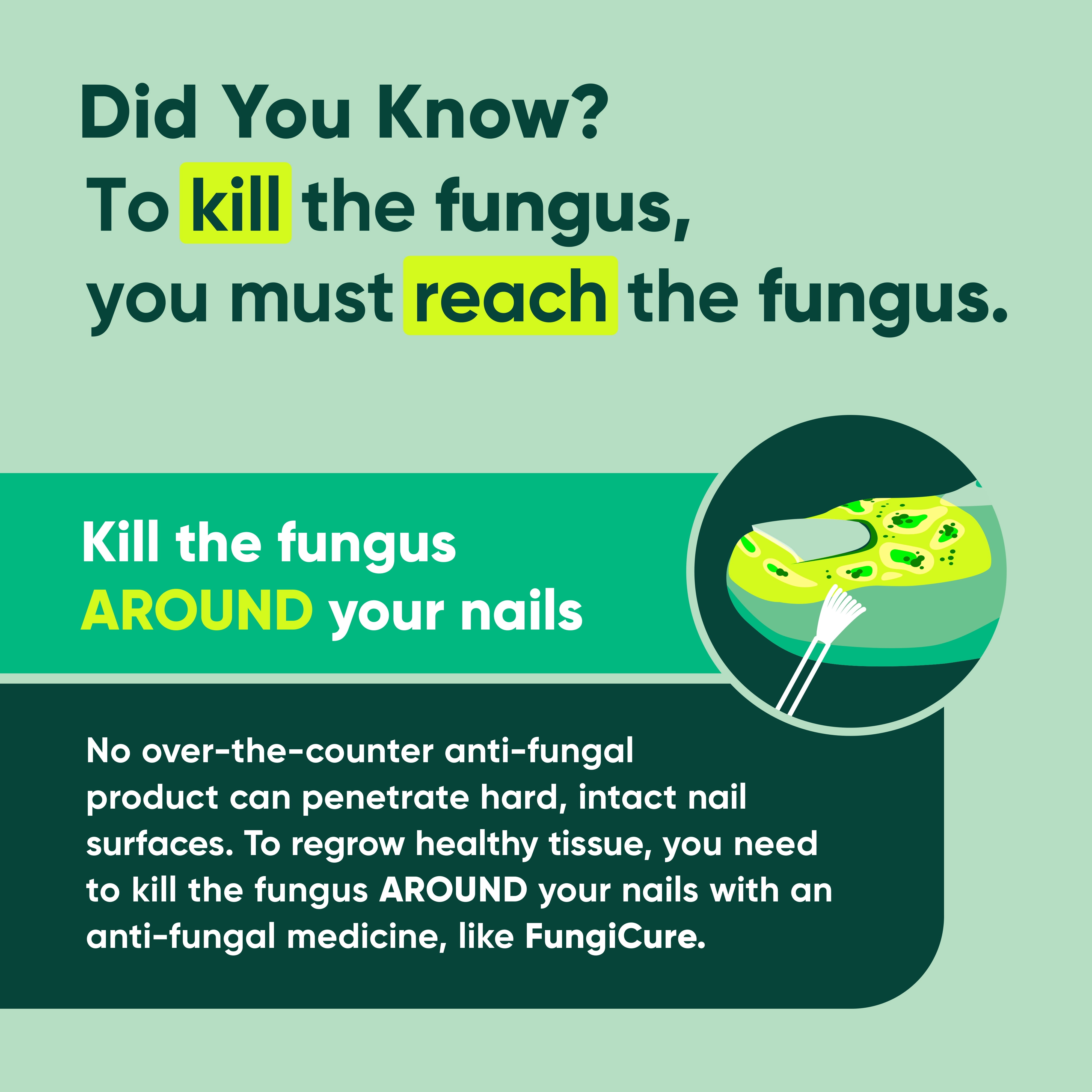 Fungicure Anti-Fungal Liquid - Nothing Stronger Without an RX - Clinically Proven - 1 fl oz
