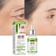 thumbnail image 5 of IBeaLee Anti Wrinkle&Firming Eye essence to remove fine lines at the corners of the eyes Eye bags Eye essence cross-border exclusive supply, 5 of 5
