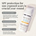 thumbnail image 6 of Skinuva® Scar+ Cream with SPF 30 for Face & Body - Old & New Scar Treatment for Surgery, Burns & Other Skin Trauma (0.5 oz), 6 of 8