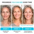 thumbnail image 4 of Crema hidratante REMEDIAL PURITY AESTHETICS EXPERIENCE Retinol 55ml, 4 of 9