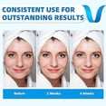 thumbnail image 2 of Sangle de Levage V line, Machine Réductrice de Double Menton, Ceintures Tonifiantes Électriques pour le Visage, Exerciseur de Mâchoire 2 Modes, Masseur de Modelage du Visage V, 2 of 5