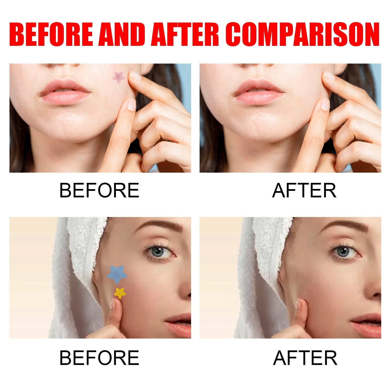 ucing Skin Care Skin Removal Patch Face Tape for Makeup Face Scrub Pads Scalp Roller Pick up Asian Makeup Skin Remover Device Pimples Remover Big Items under $5 Belly Pellet Face