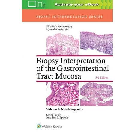 UPC: 9781496337276 | Biopsy Interpretation: Biopsy Interpretation of the Gastrointestinal Tract Mucosa: Volume 1: Non-Neoplastic (Hardcover)