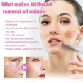 thumbnail image 4 of Aceite reparador de piel Eelhoe, aclarador de piel facial, bloqueador de manchas de café, hidratante, cuidado de la piel facial, aceite esencial, 1 unidad, 4 of 5